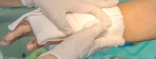 Mơ thấy bị bỏng nước sôi – Giải mã giấc mơ báo hiệu nỗi đau, cảnh báo và cơ hội