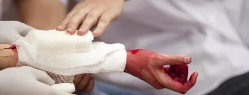 Giải mã giấc mơ thấy bị chảy máu tay – Dấu hiệu cảnh báo vận hạn