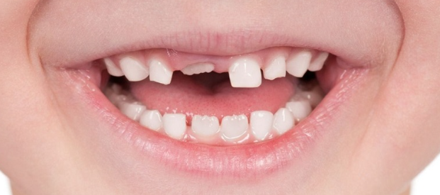 Thể hiện sự lo âu về ngoại hình.