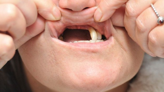 Biểu tượng cho sự thay đổi và mất mát.