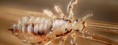 Mơ thấy chấy đầy đầu tiết lộ điều gì về tâm trạng hiện tại?