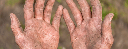 Mơ Thấy Cứt Bám Ngón Tay – Điềm Báo Lạ Và Con Số May Mắn Từ Giấc Mơ