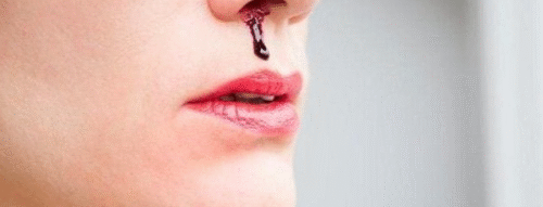 Mơ Thấy Máu Chảy Mũi – Điềm Báo Gì Và Con Số May Mắn Liên Quan