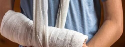 Giải mã ý nghĩa giấc mơ thấy bị gãy tay và điều cần lưu ý