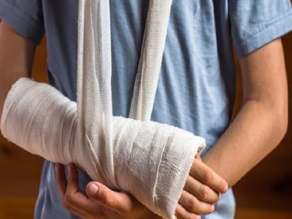 Mơ thấy bị gãy tay mang nhiều ý nghĩa