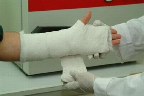 Mơ thấy gãy tay nhắc nhở bạn đang cần hỗ trợ