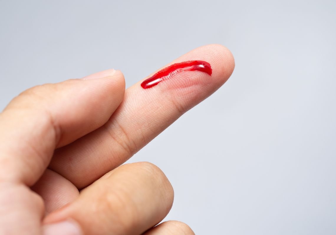 Mơ thấy cắt móng tay bị chảy máu